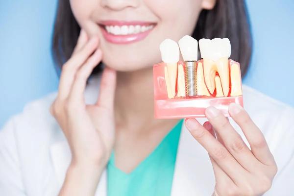 Что нужно знать перед имплантацией зубов. Сколько прослужат зубные имплантаты