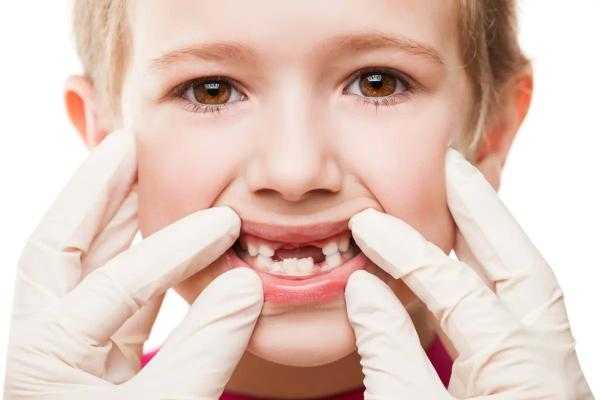 Вредные привычки детей, которые приводят к проблемам с зубами во взрослом возрасте. Что такое неправильный прикус